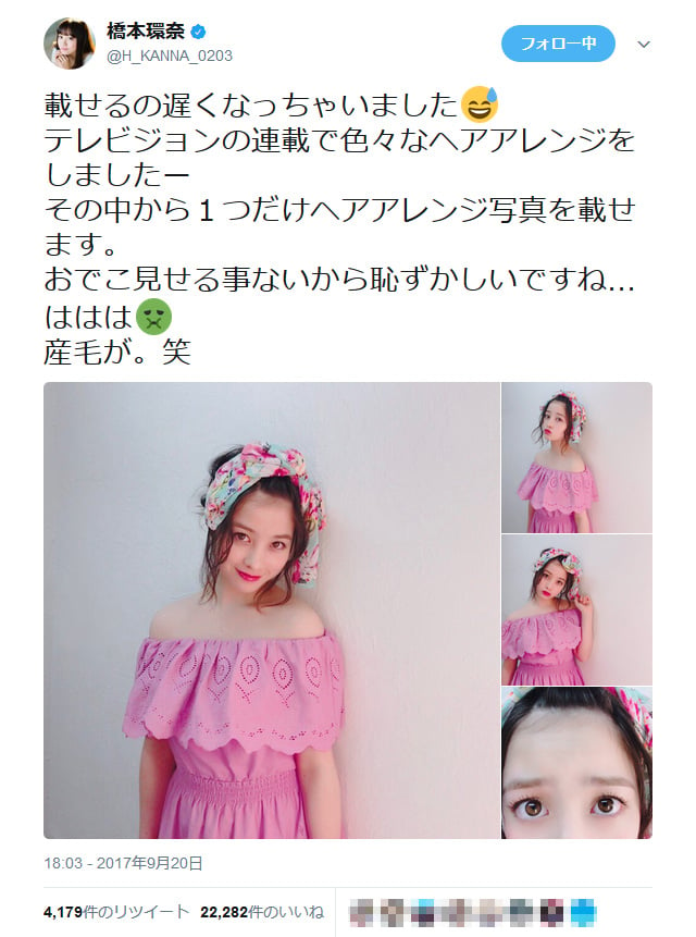 橋本環奈さん おでこ見せる事ないから恥ずかしいですね ははは ヘアアレンジ写真に大反響 ガジェット通信 Getnews