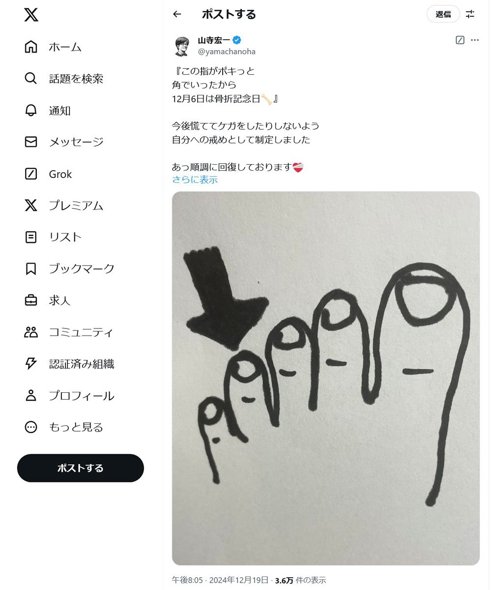 山寺宏一さん「この指がポキっと 角でいったから 12月6日は骨折記念日」Twitter(X)で「自分への戒めとして制定しました」