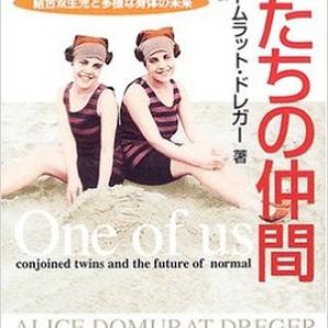 結合双生児の 分離されたくない という気持ち その背景にあるものとは ガジェット通信 Getnews