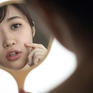 芸能人にも多いガミースマイル 原因と治療法を徹底解説 ガジェット通信 Getnews